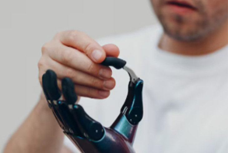 Contrôle myoélectrique intelligent d’une prothèse de main : évaluation des besoins des utilisateurs potentiels et de la performance